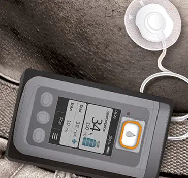 Continuous infusion in Parkinson's by the help of the D-mine Pump.